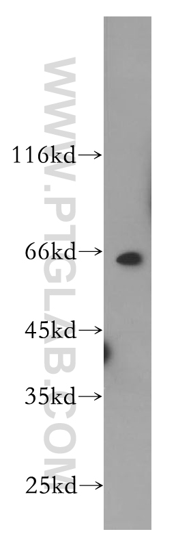 PRCC Polyclonal antibody