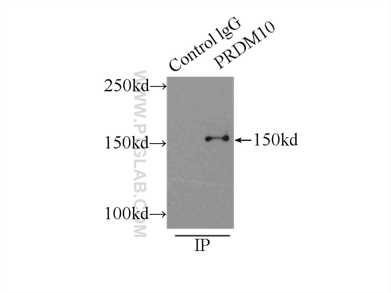 IP experiment of mouse testis using 23827-1-AP