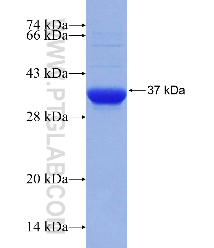 PRDM12 fusion protein Ag30655 SDS-PAGE