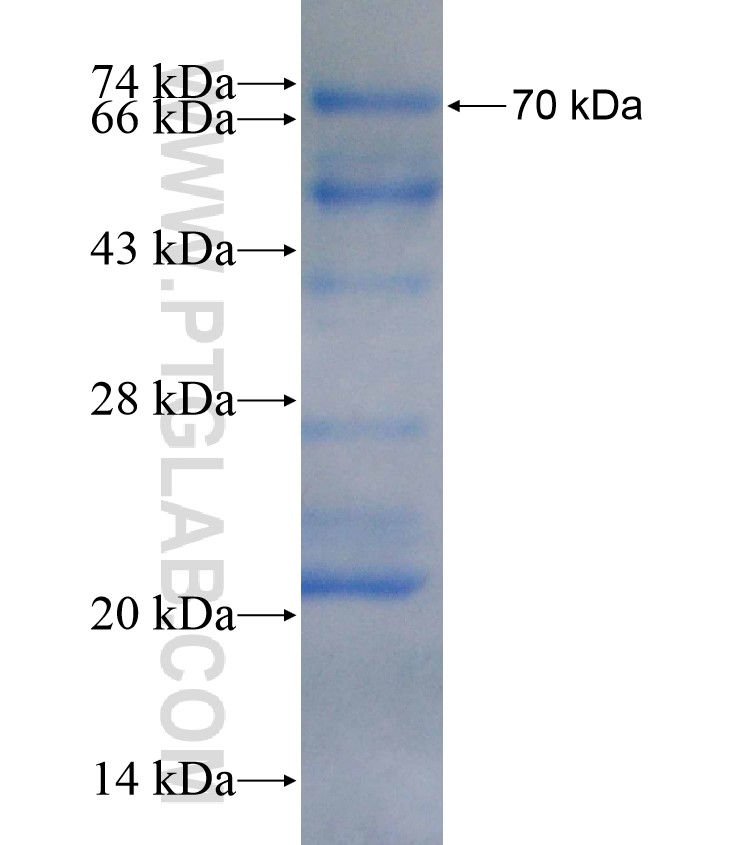 PRDM14 fusion protein Ag18025 SDS-PAGE PRDM14 fusion protein Ag18025 SDS-PAGE