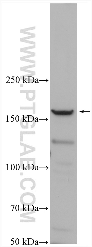 WB analysis of K-562 using 55361-1-AP