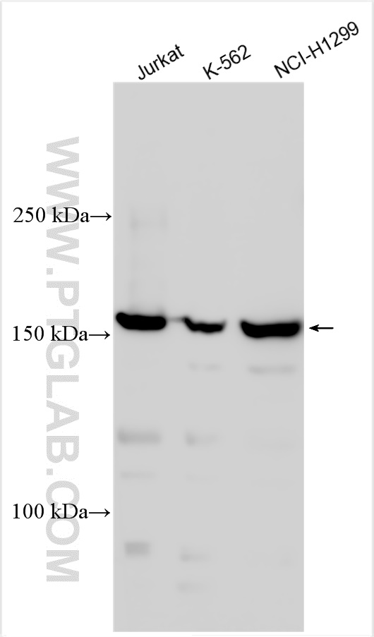 WB analysis using 55361-1-AP (same clone as 55361-1-PBS)