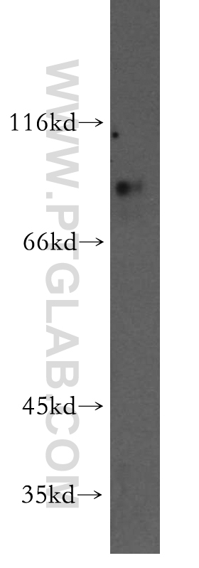 WB analysis of mouse pancreas using 13792-1-AP