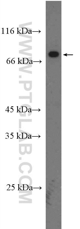 WB analysis of mouse ovary using 14126-1-AP