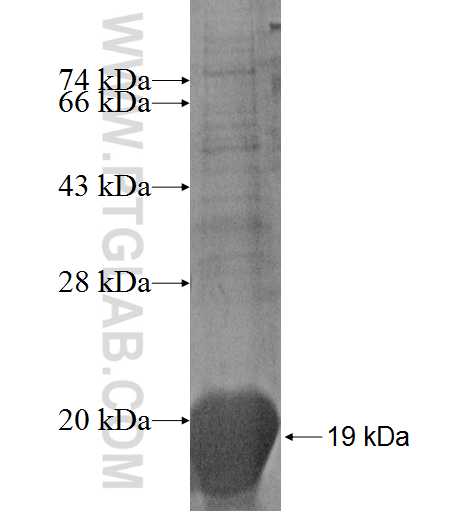 PRDM5 fusion protein Ag5376 SDS-PAGE
