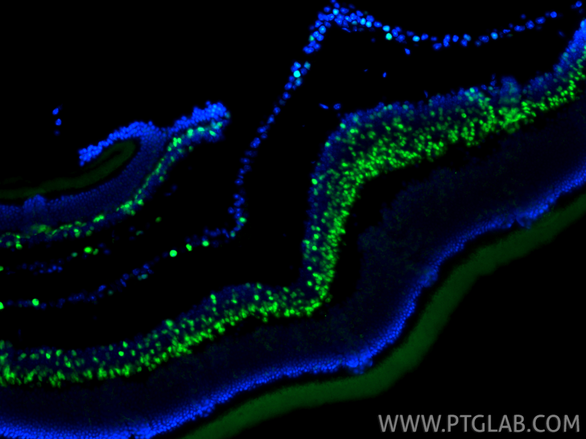 IF Staining of mouse eye using 84716-2-RR (same clone as 84716-2-PBS) IF Staining of mouse eye using 84716-2-RR (same clone as 84716-2-PBS)