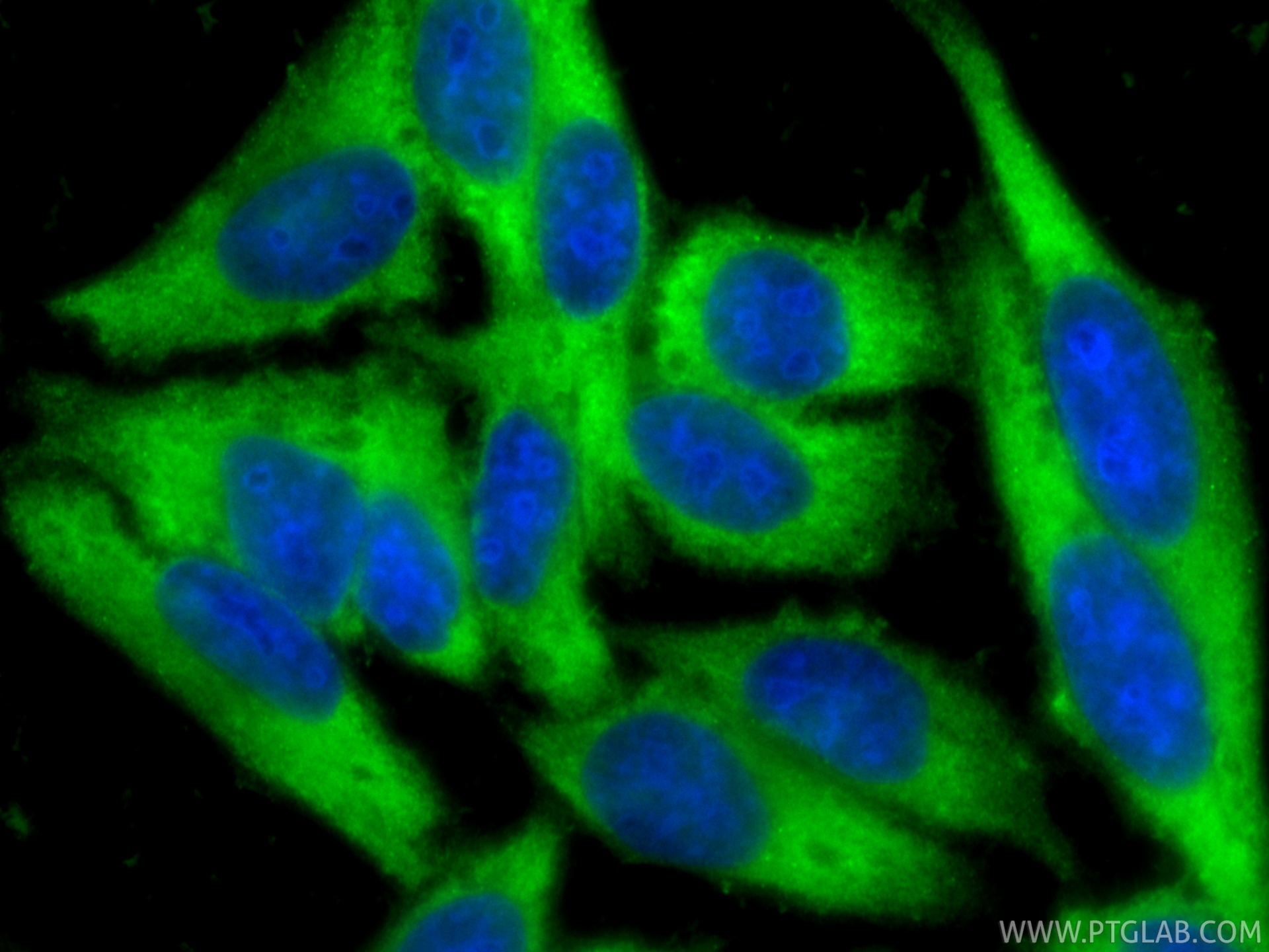 IF Staining of HepG2 using 15816-1-AP