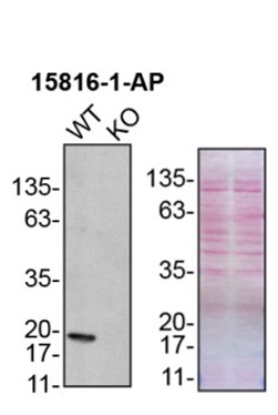 WB analysis of U2OS using 15816-1-AP