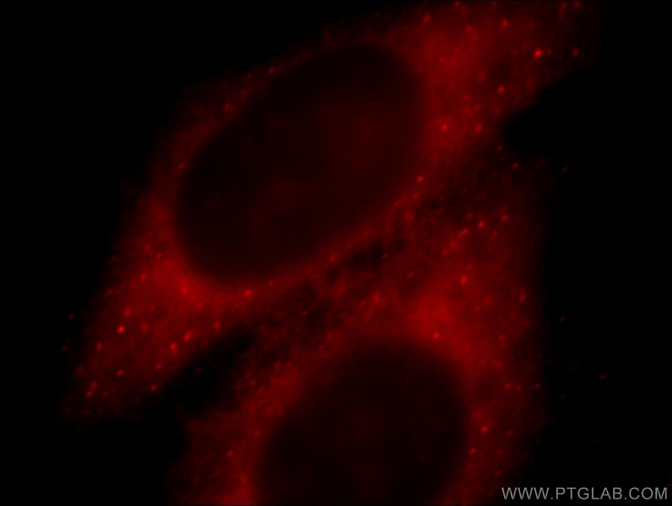 IF Staining of HepG2 using 20568-1-AP