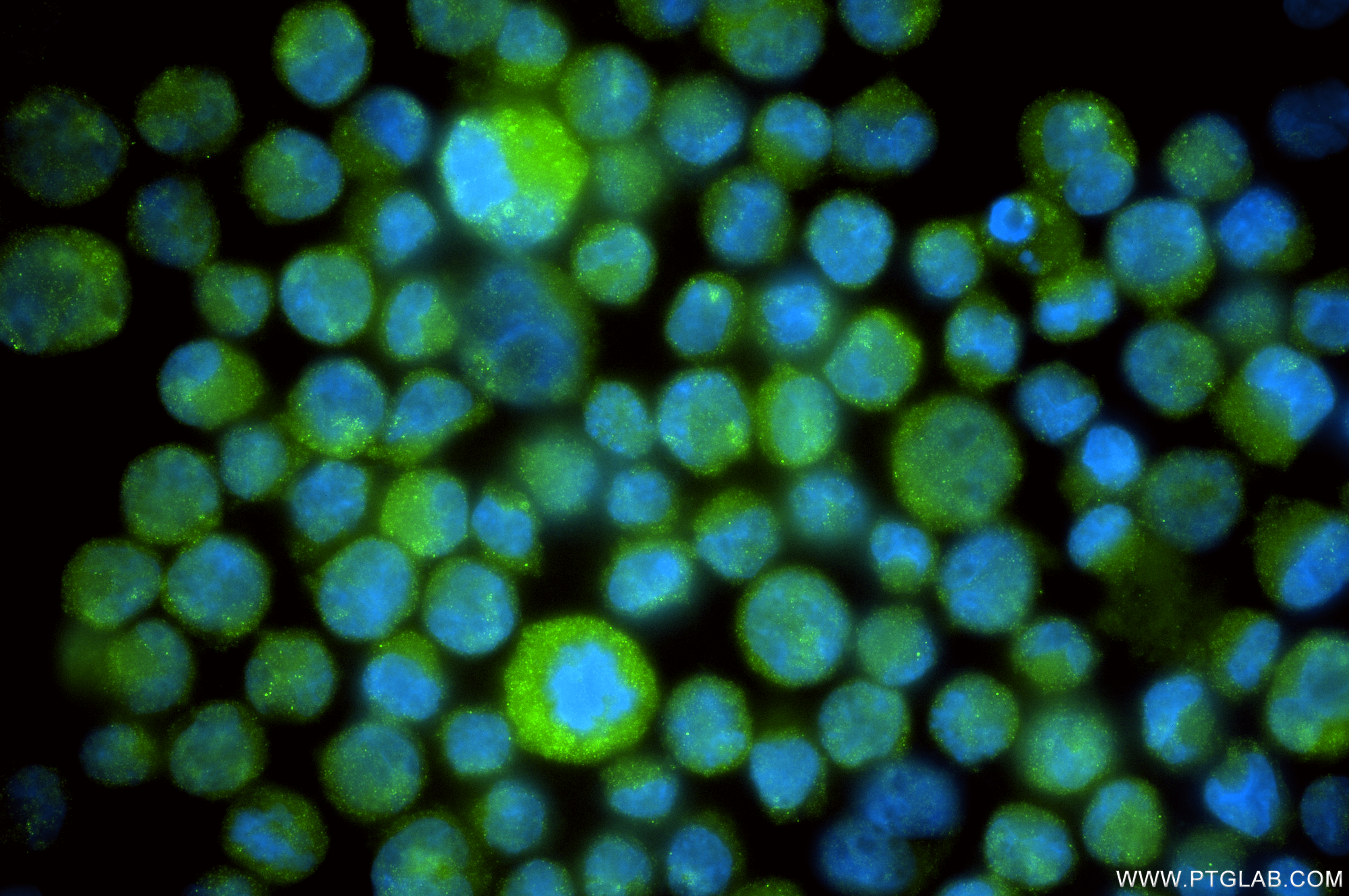 IF Staining of K-562 using 86589-1-RR IF Staining of K-562 using 86589-1-RR