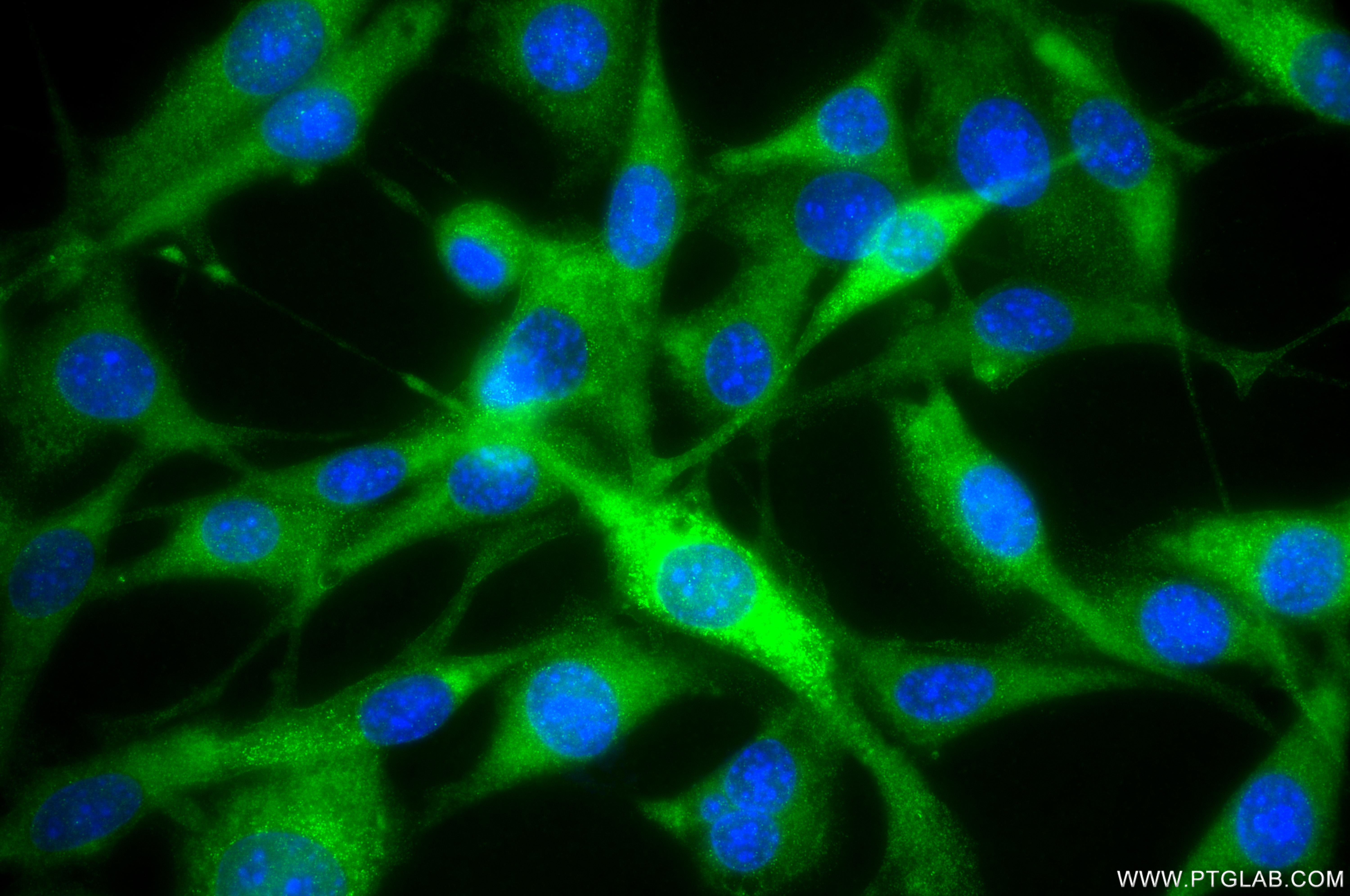 IF Staining of NIH/3T3 using 86589-1-RR IF Staining of NIH/3T3 using 86589-1-RR