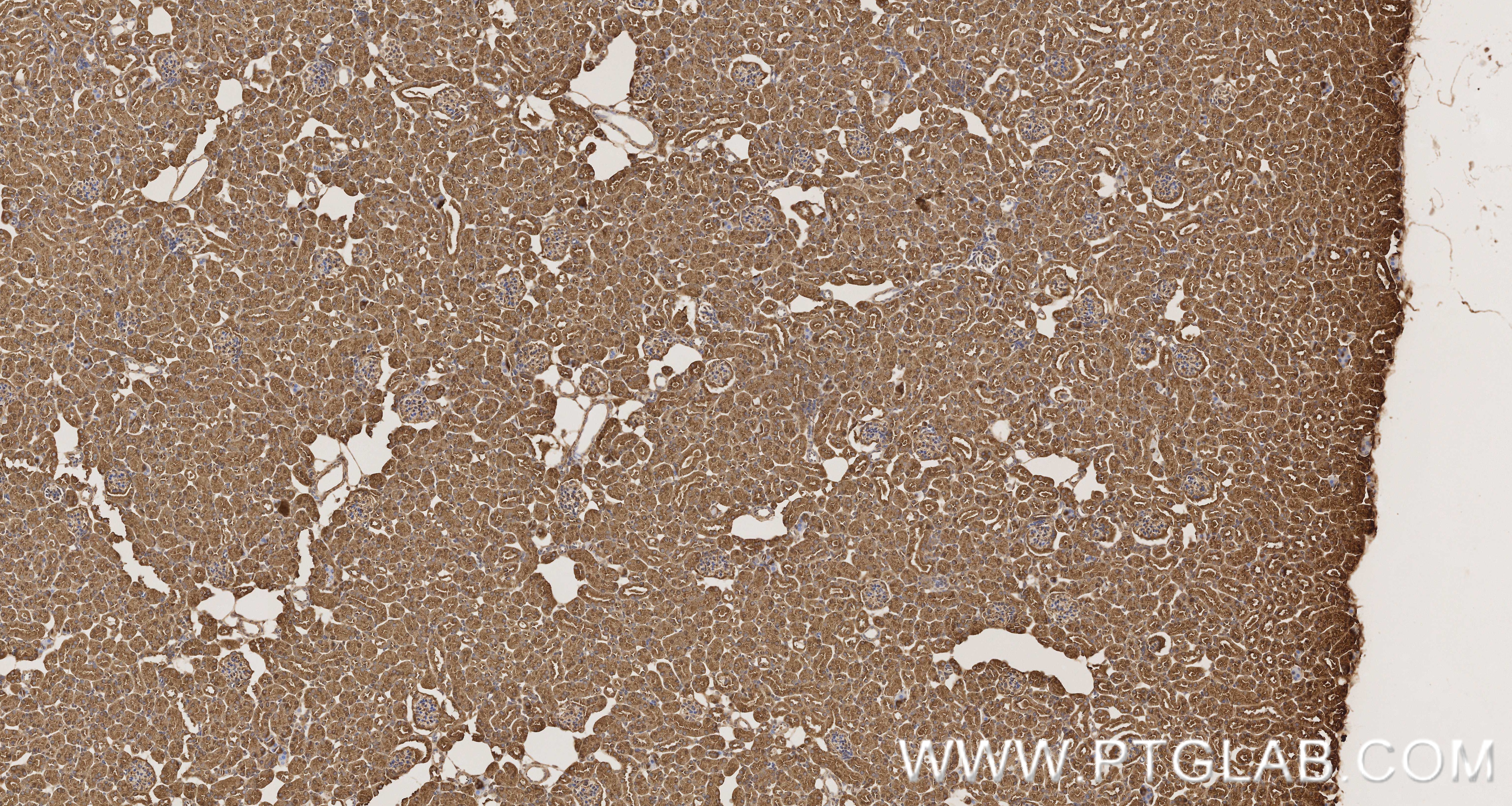 IHC staining of mouse kidney using 86589-1-RR IHC staining of mouse kidney using 86589-1-RR