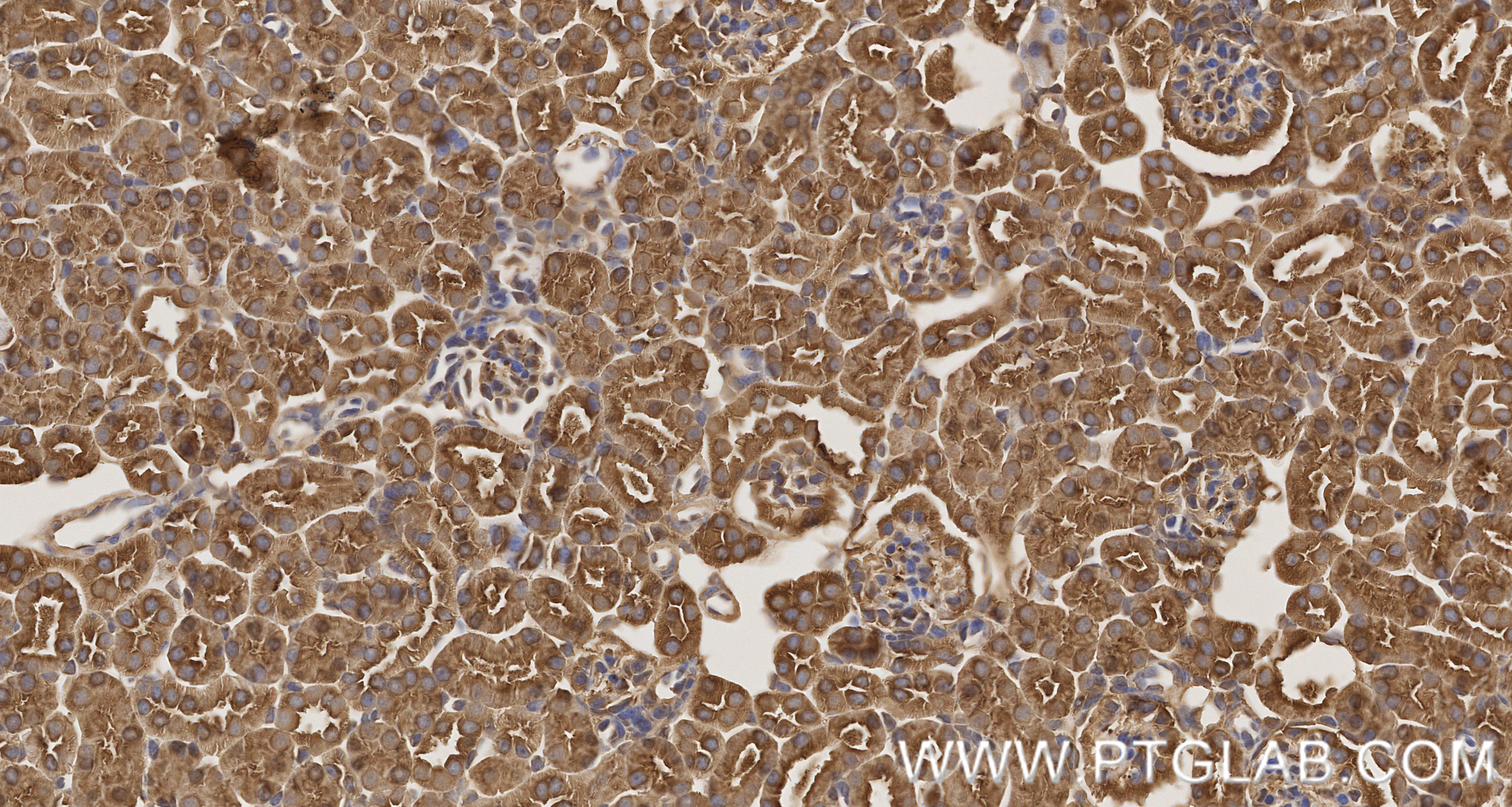 IHC staining of mouse kidney using 86589-1-RR IHC staining of mouse kidney using 86589-1-RR