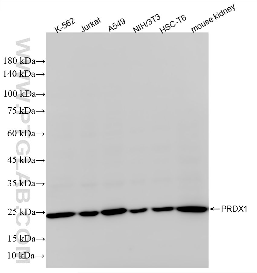 WB analysis using 86589-1-RR WB analysis using 86589-1-RR