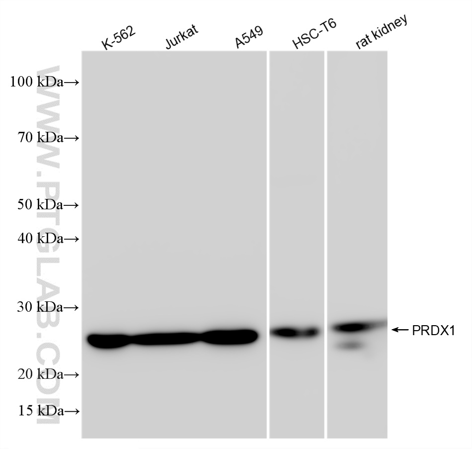 WB analysis using 86589-2-RR