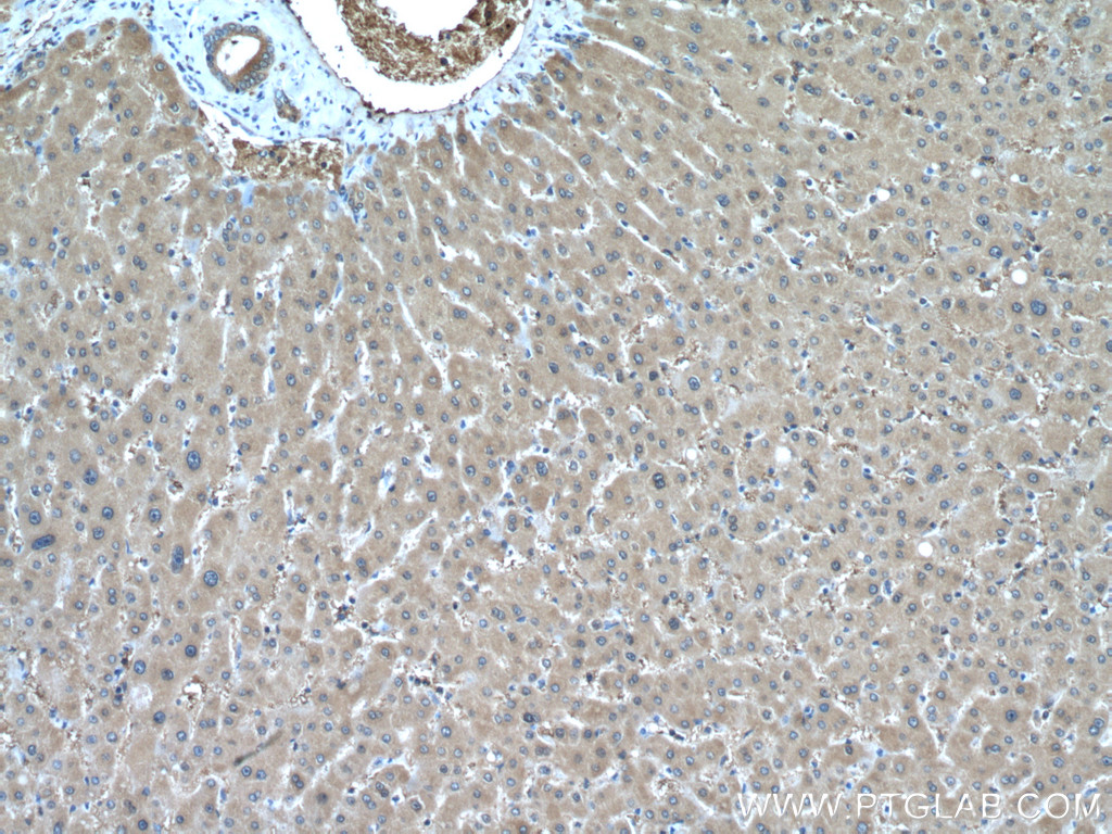 IHC staining of human liver using 10545-2-AP