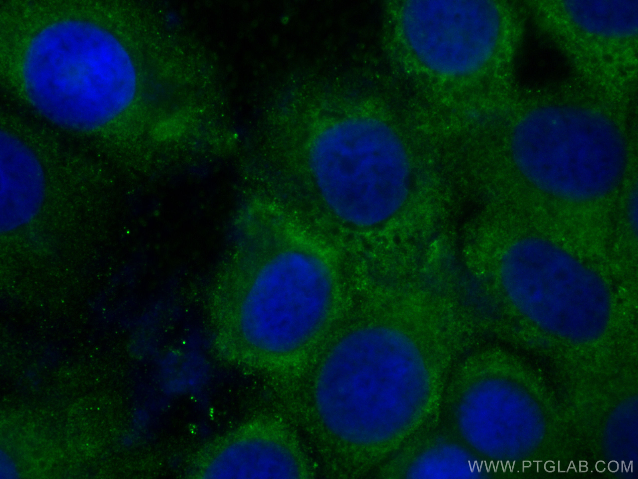 IF Staining of MCF-7 using 60202-1-Ig
