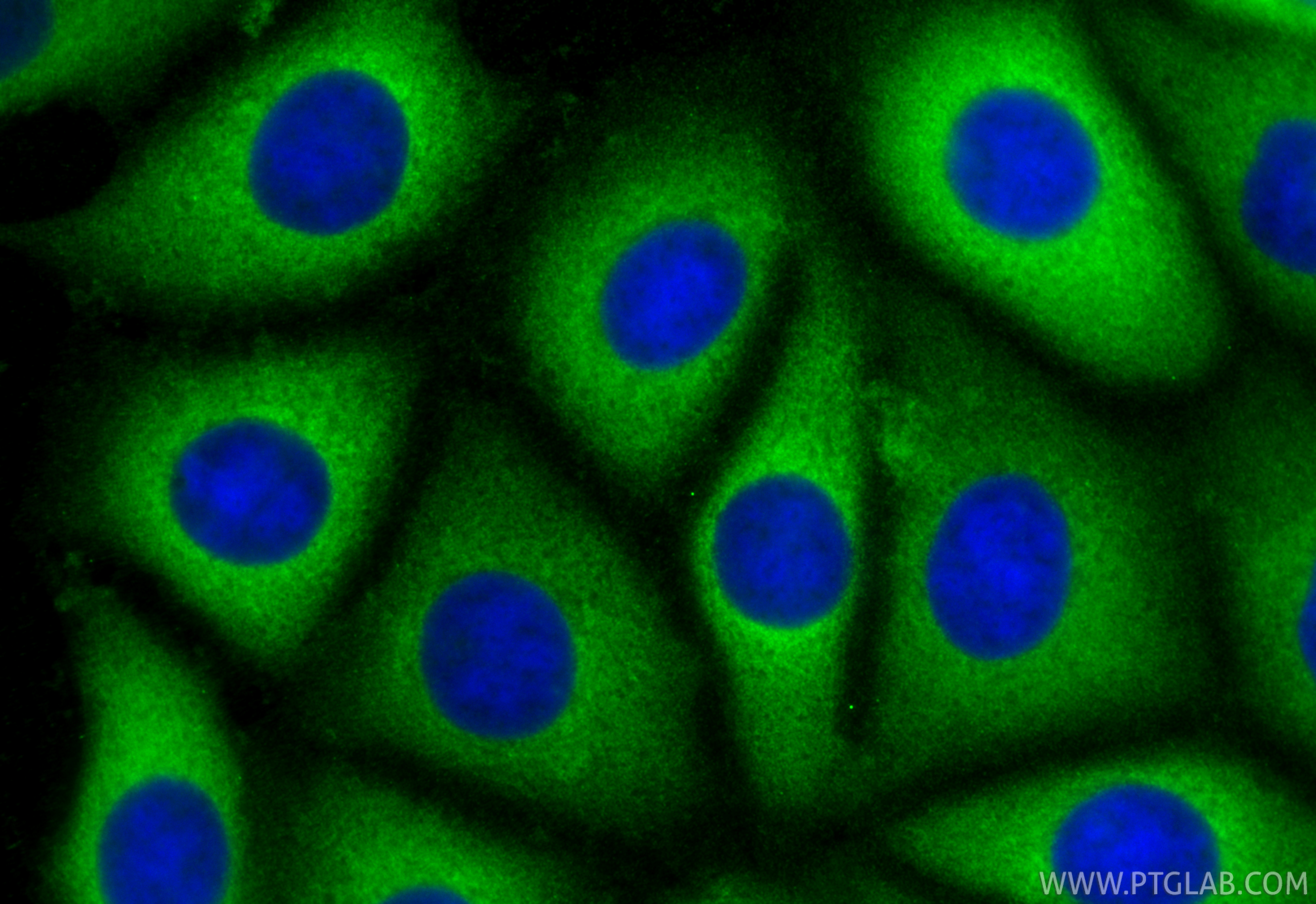 IF Staining of MCF-7 using 60202-1-Ig