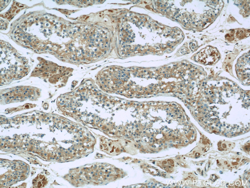 IHC staining of human testis using 60202-1-Ig