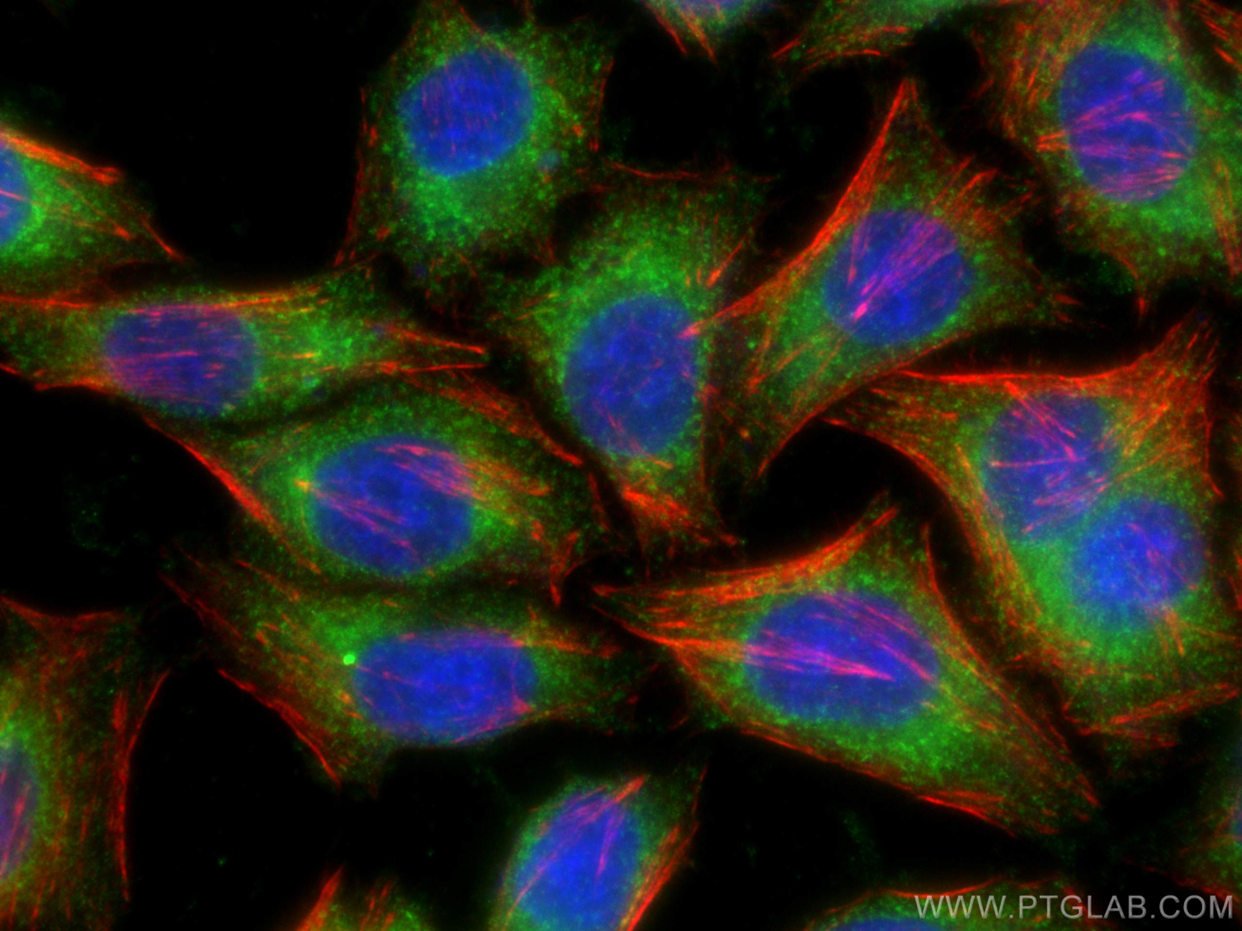 IF Staining of HepG2 using 10703-1-AP