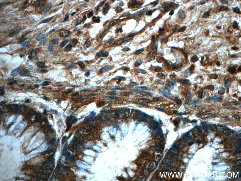 IHC staining of human colon using 60286-1-Ig