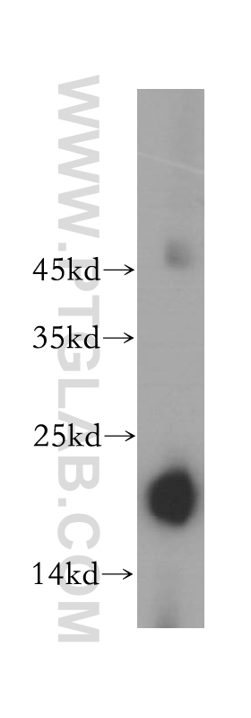 PRX5 Polyclonal antibody