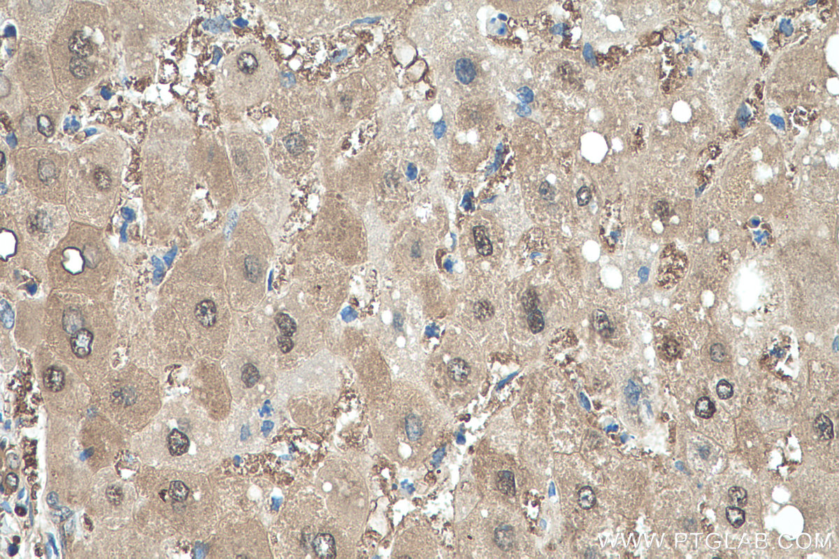 IHC staining of human liver using 13585-1-AP