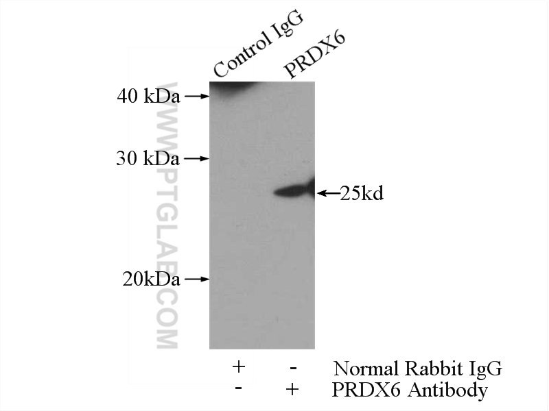 IP experiment of HeLa using 13585-1-AP