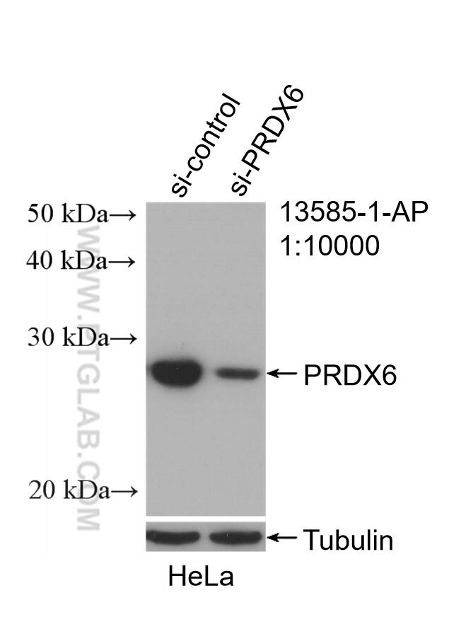 WB analysis of HeLa using 13585-1-AP