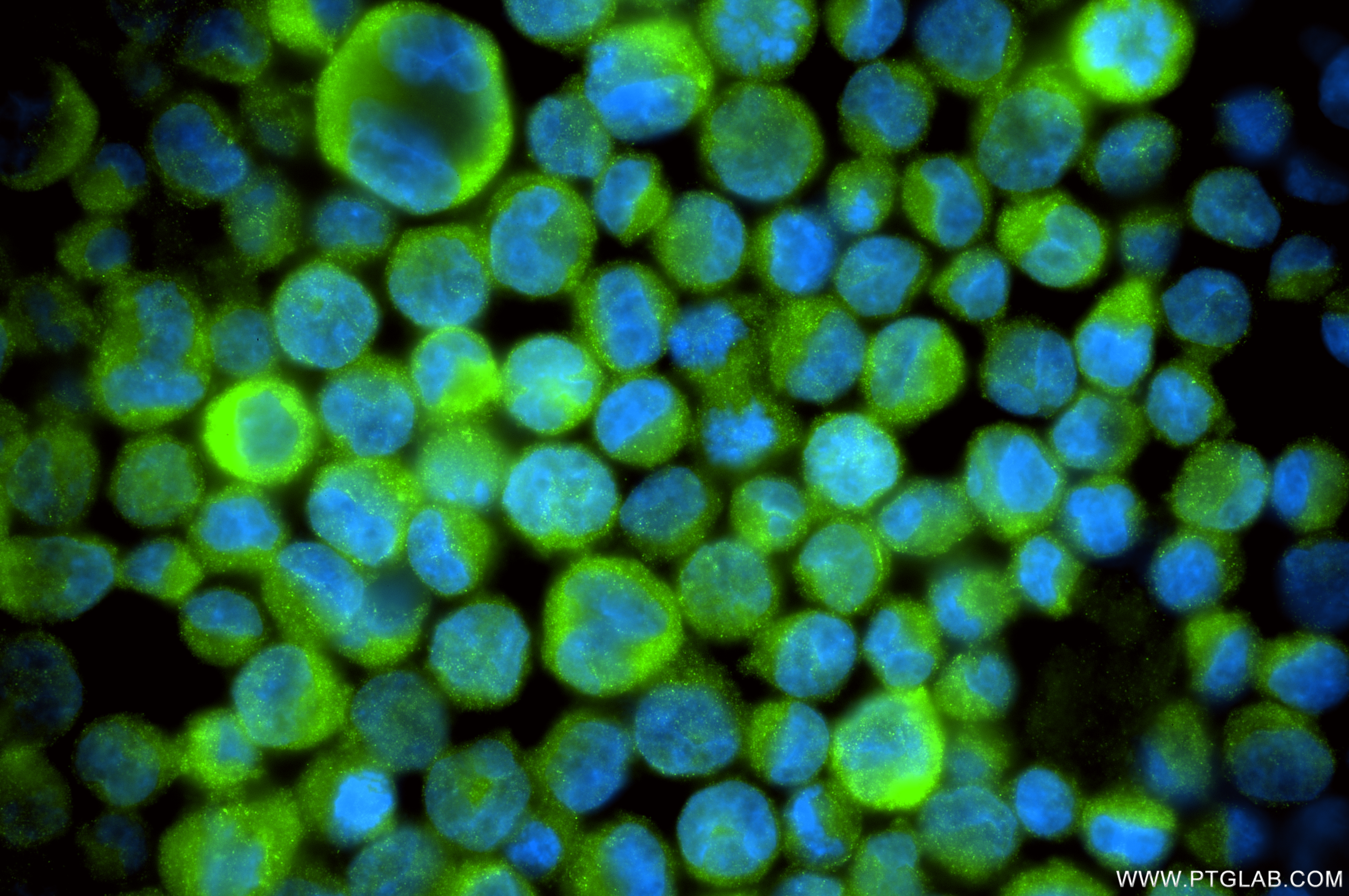 IF Staining of K-562 using 86368-1-RR (same clone as 86368-1-PBS) IF Staining of K-562 using 86368-1-RR (same clone as 86368-1-PBS)