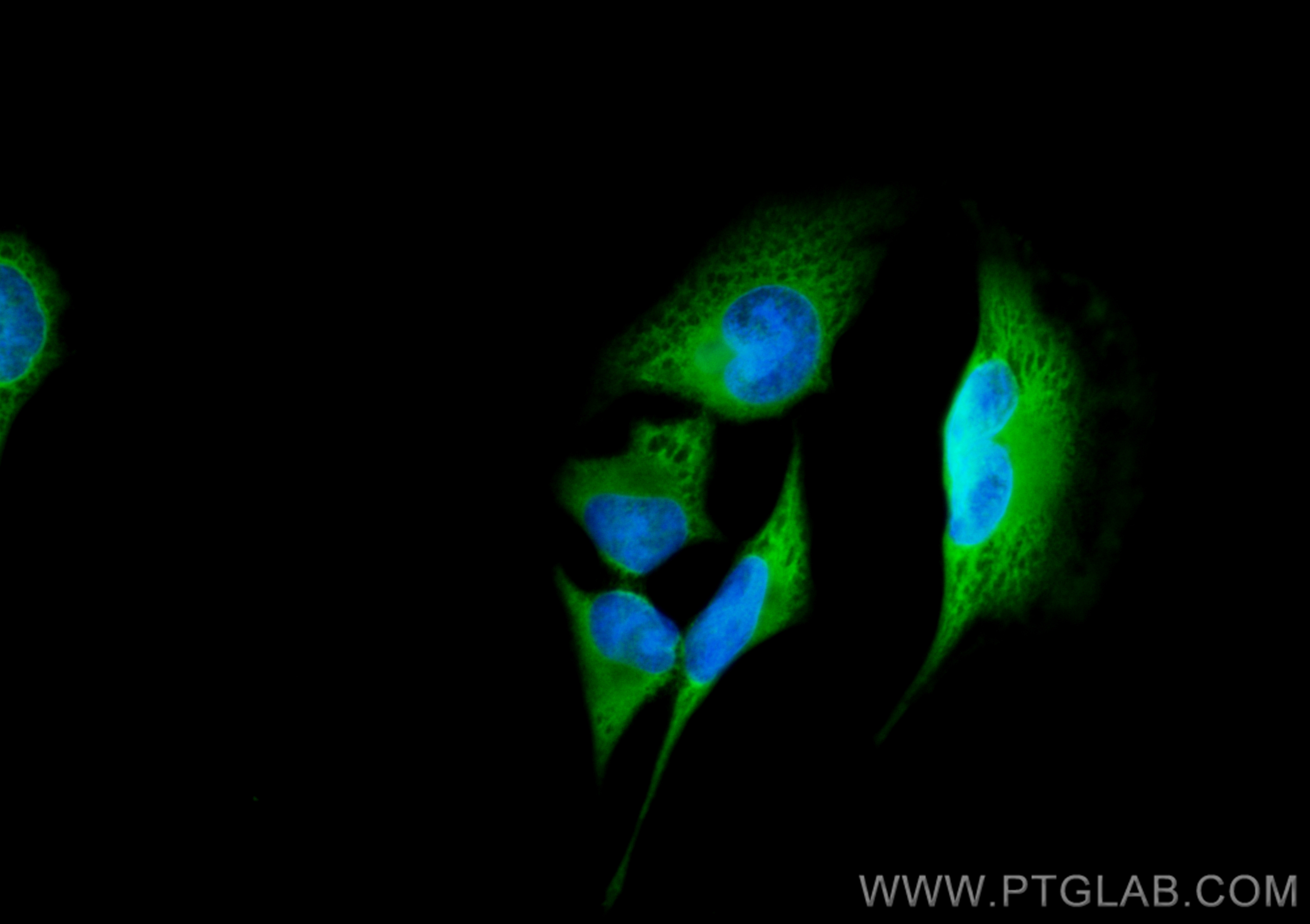 IF Staining of HeLa using CL488-13585