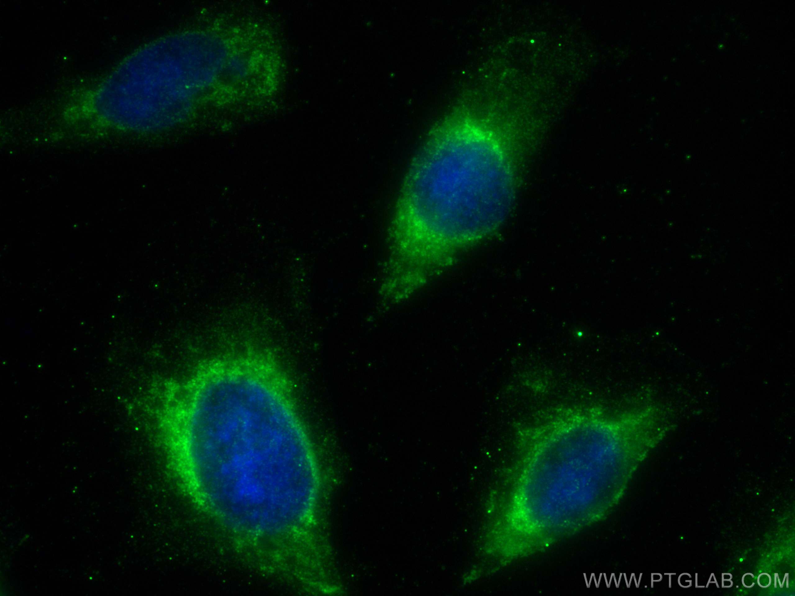 IF Staining of U2OS using 23783-1-AP