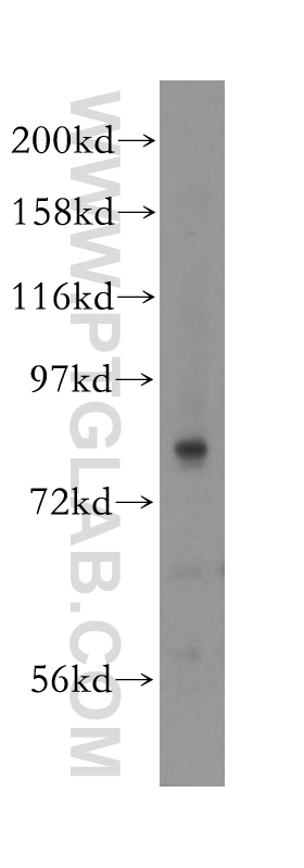 WB analysis of human lung using 11536-1-AP