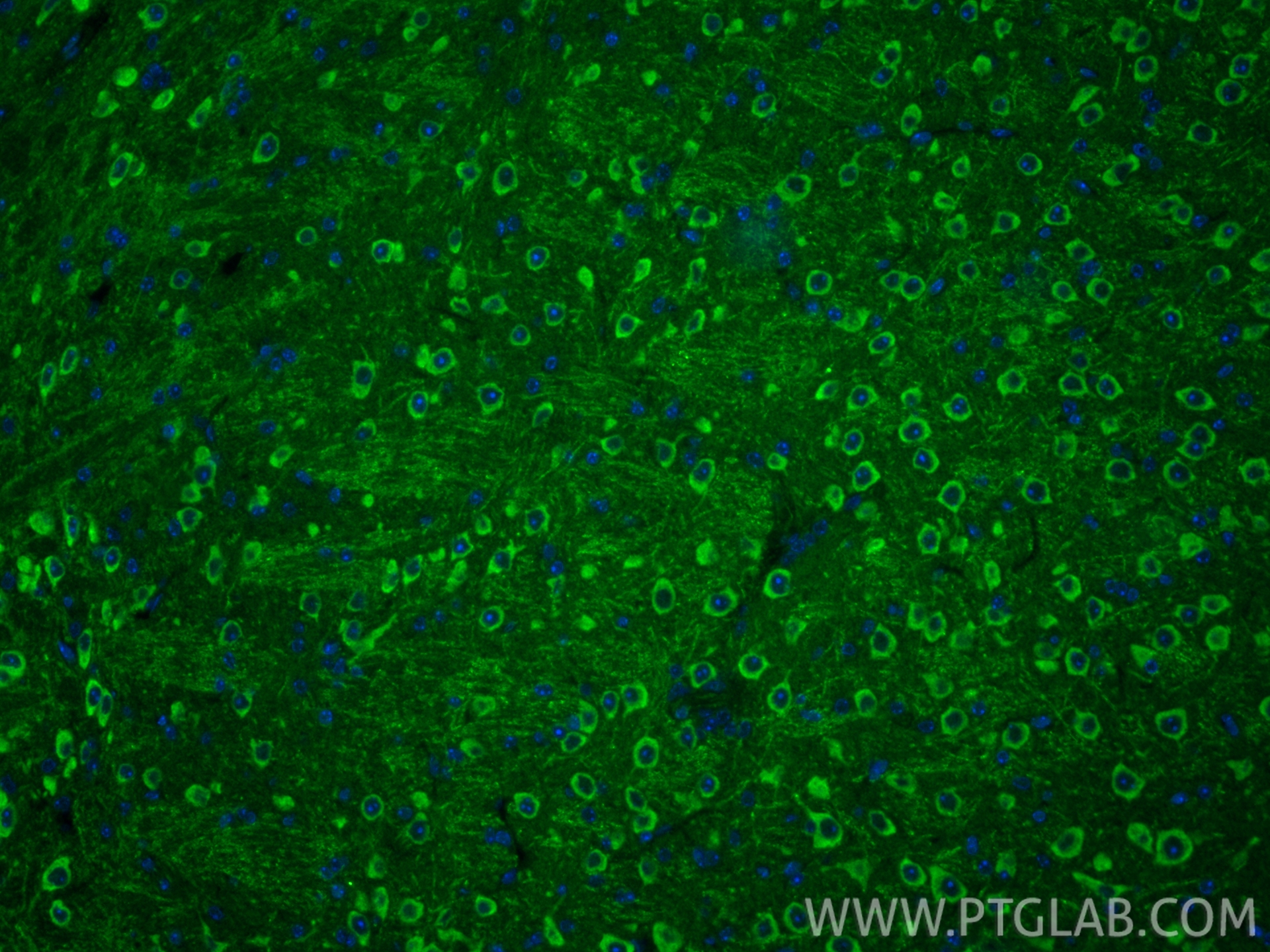 IF Staining of mouse brain using 12478-1-AP IF Staining of mouse brain using 12478-1-AP