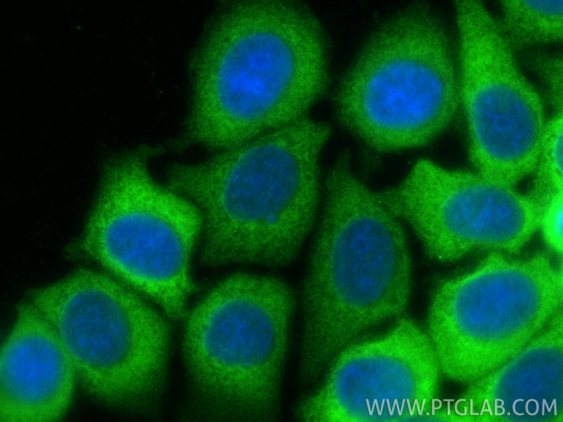 Immunofluorescent analysis of (-20°C Methanol) fixed MCF-7 cells using PREX1 antibody (33193-1-AP) at dilution of 1:400 and CoraLite®488-Conjugated Goat Anti-Rabbit IgG(H+L) (<a class='green' href='/productredirect?CatalogNo=SA00013-2' target='_blank'>SA00013-2</a>). IF Staining of MCF-7 using 33193-1-AP