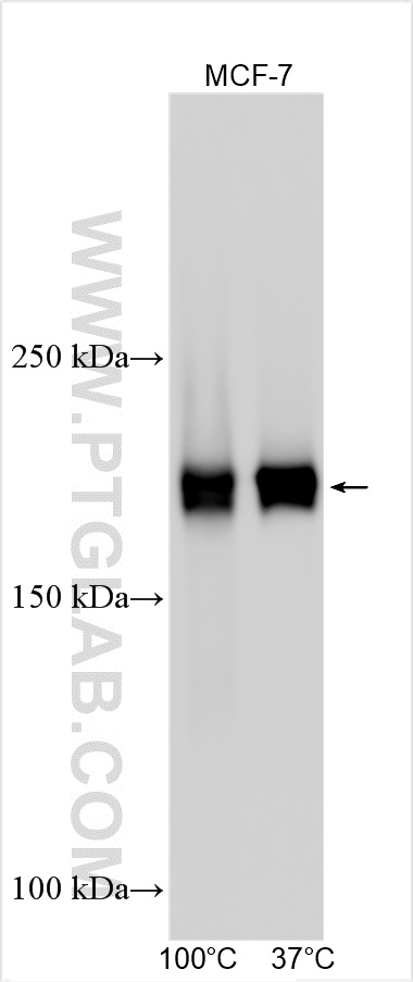Various lysates were subjected to SDS PAGE followed by western blot with 33193-1-AP (PREX1 antibody) at dilution of 1:4000 incubated at room temperature for 1.5 hours. WB analysis using 33193-1-AP