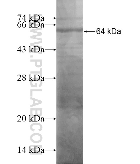 PREX2 fusion protein Ag19308 SDS-PAGE PREX2 fusion protein Ag19308 SDS-PAGE