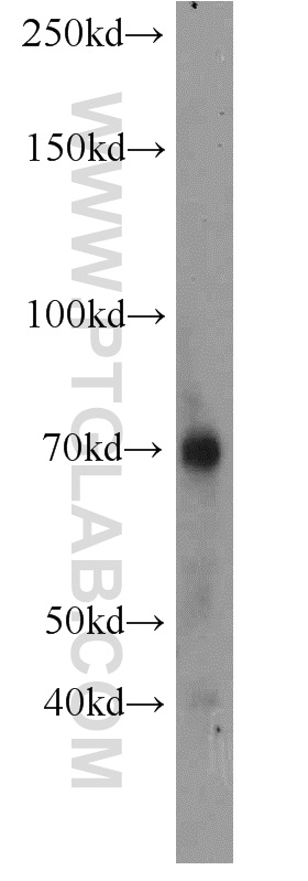 Perforin Polyclonal antibody