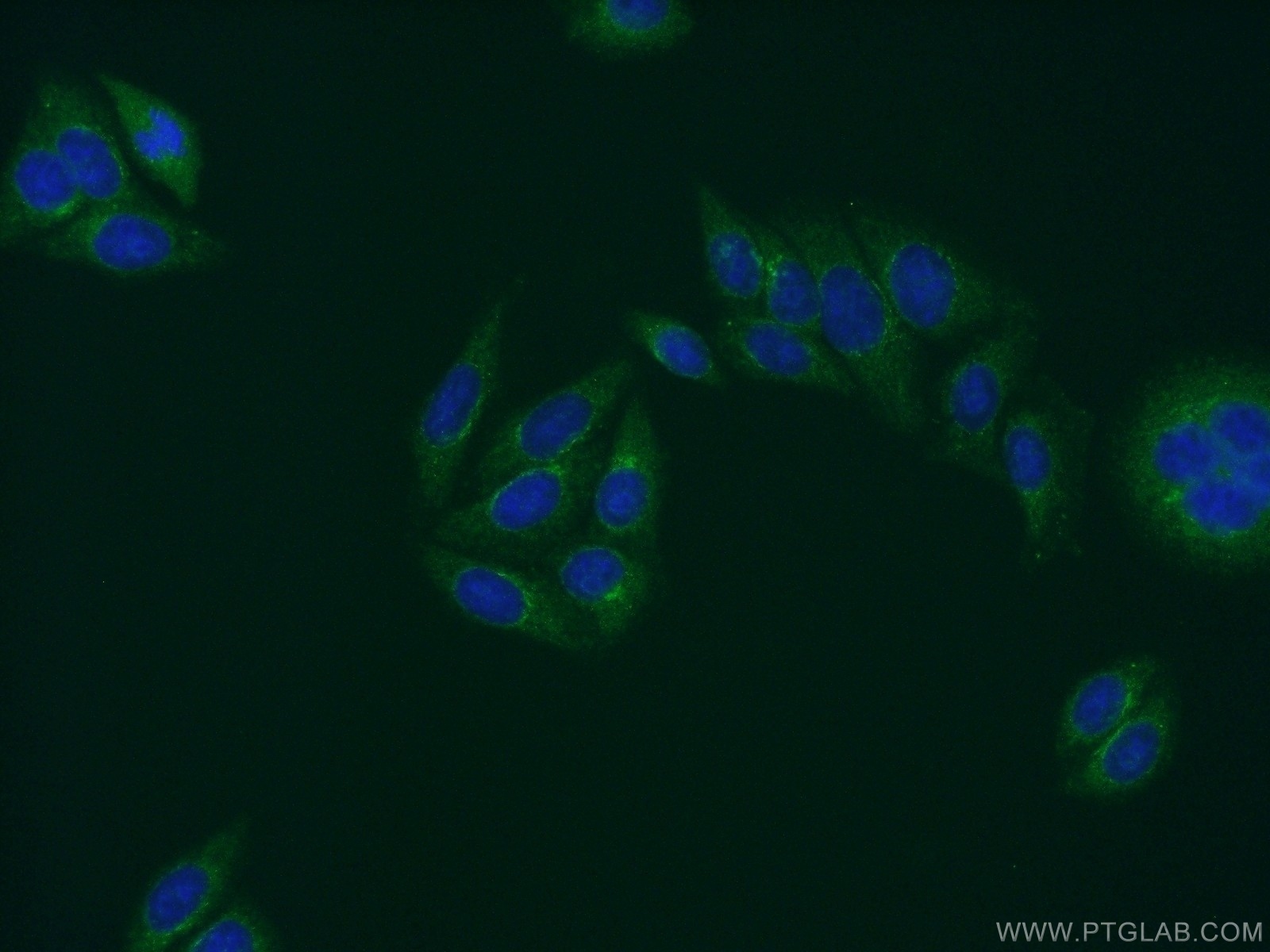 IF Staining of HepG2 using 21460-1-AP