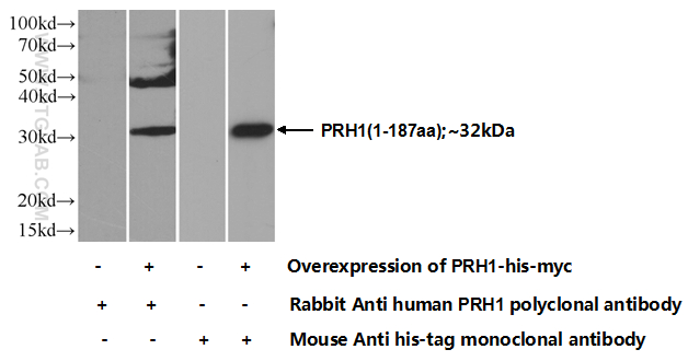 PRH1