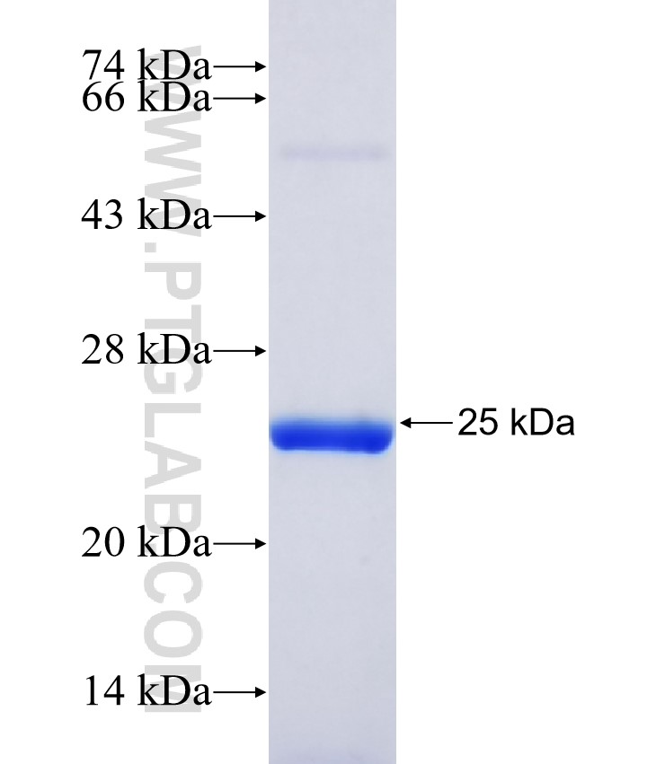 PRHOXNB fusion protein Ag37195 SDS-PAGE PRHOXNB fusion protein Ag37195 SDS-PAGE