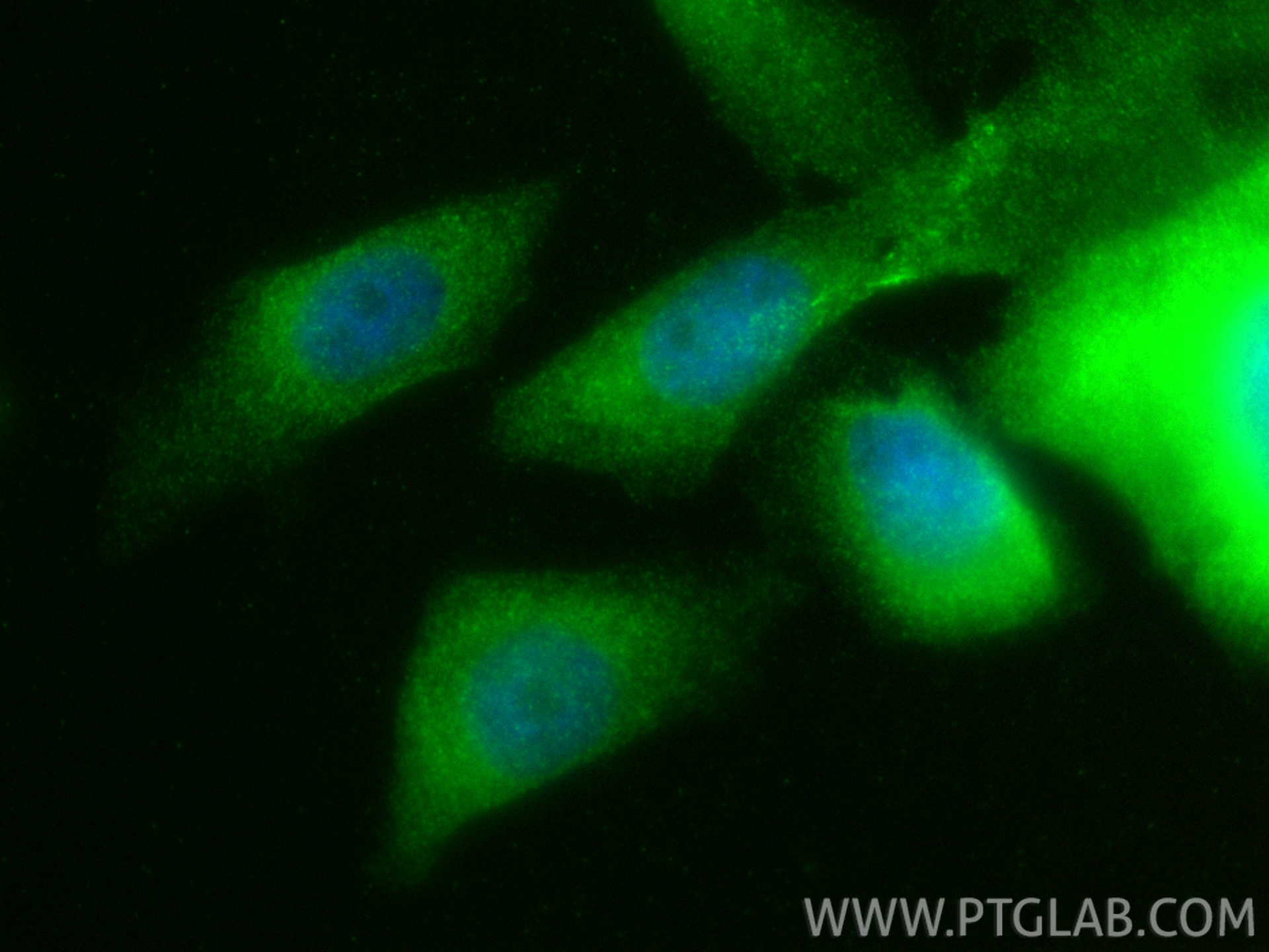 IF Staining of PC-3 using 25736-1-AP (same clone as 25736-1-PBS) IF Staining of PC-3 using 25736-1-AP (same clone as 25736-1-PBS)