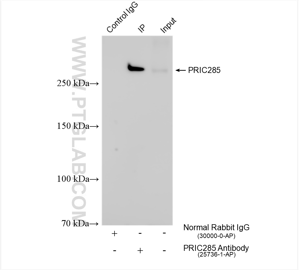 IP experiment of PC-3 using 25736-1-AP