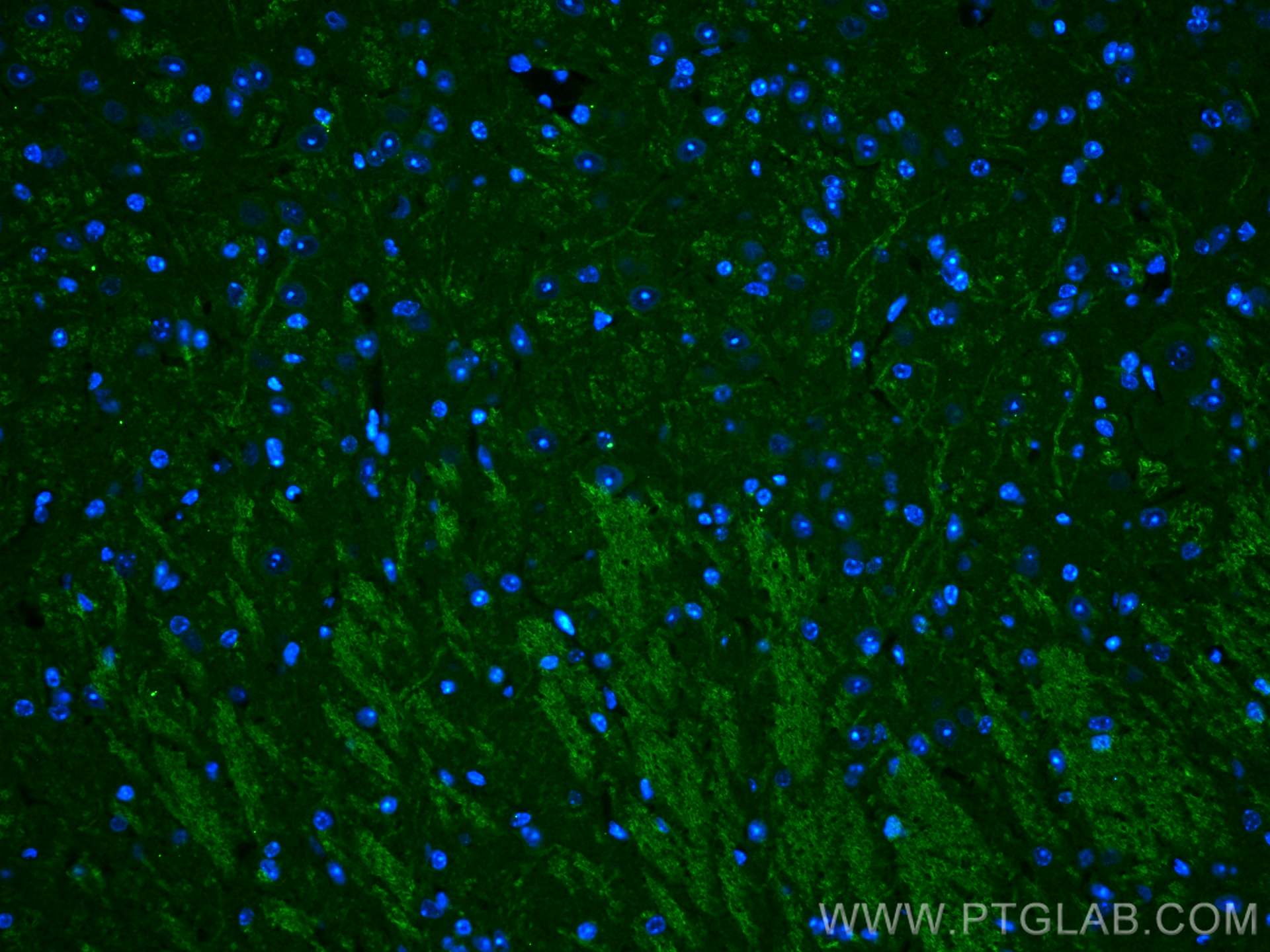 IF Staining of mouse cerebellum using 22589-1-AP
