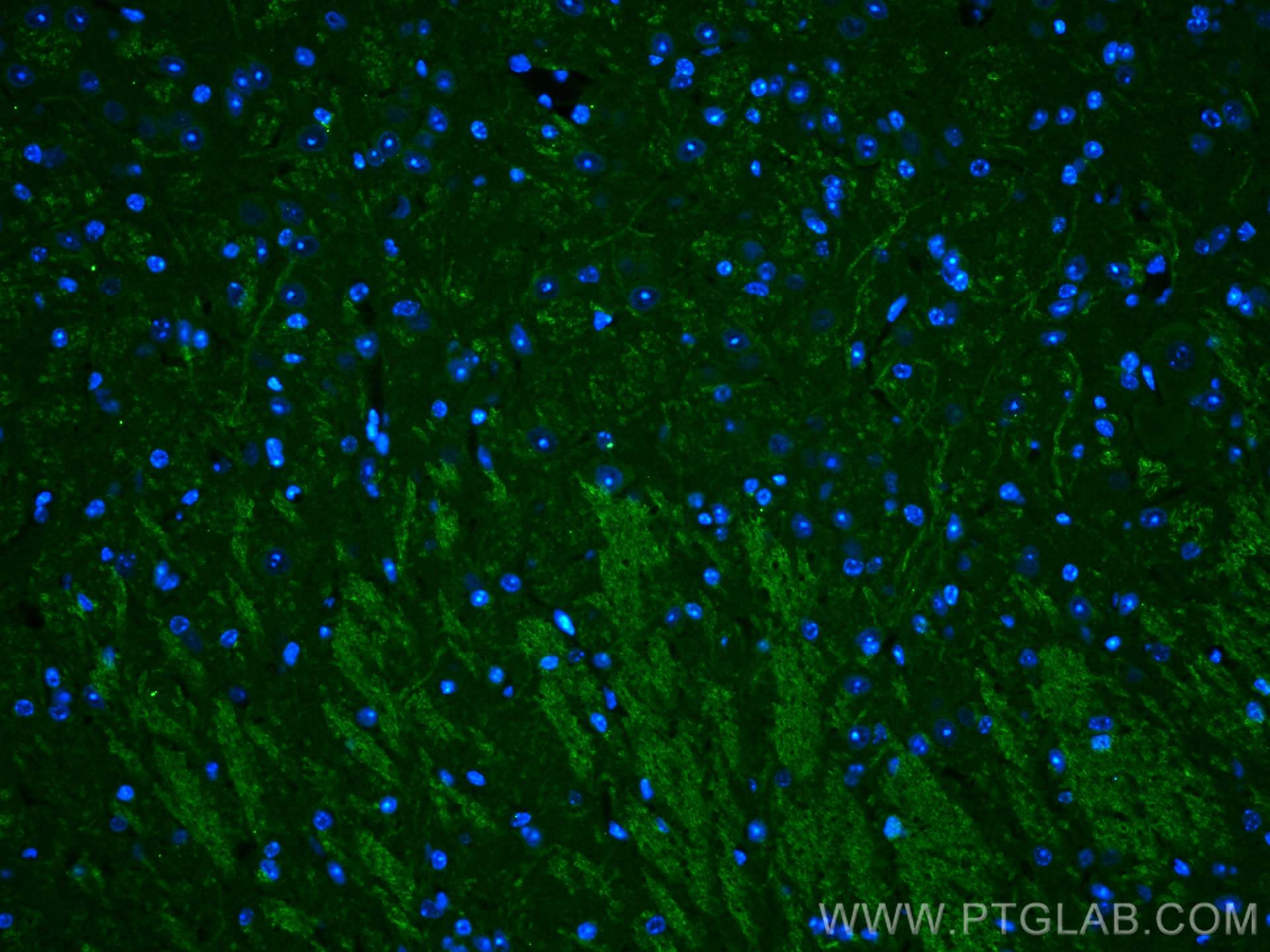 IF Staining of mouse cerebellum using 22589-1-AP