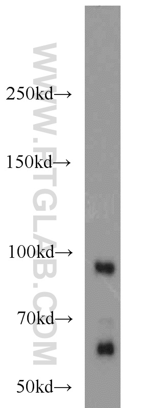 WB analysis of mouse brain using 22589-1-AP