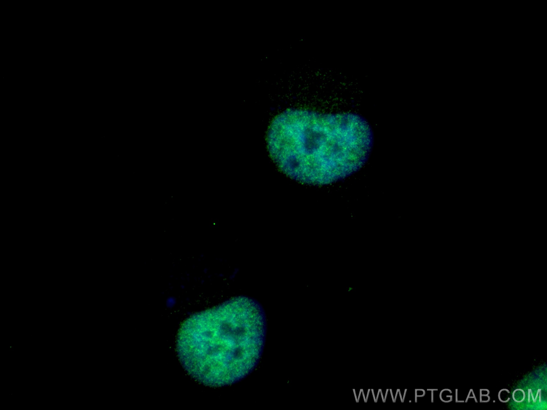 IF Staining of HeLa using 10773-1-AP