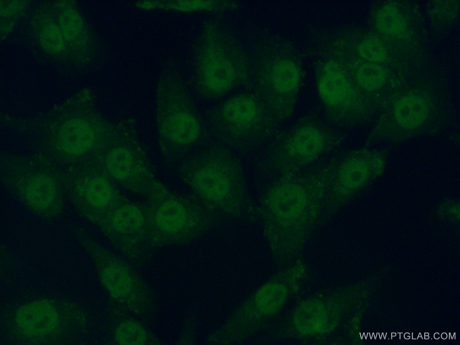 IF Staining of A375 using 11788-1-AP