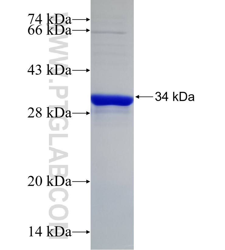 PRIM2 fusion protein Ag30340 SDS-PAGE PRIM2 fusion protein Ag30340 SDS-PAGE