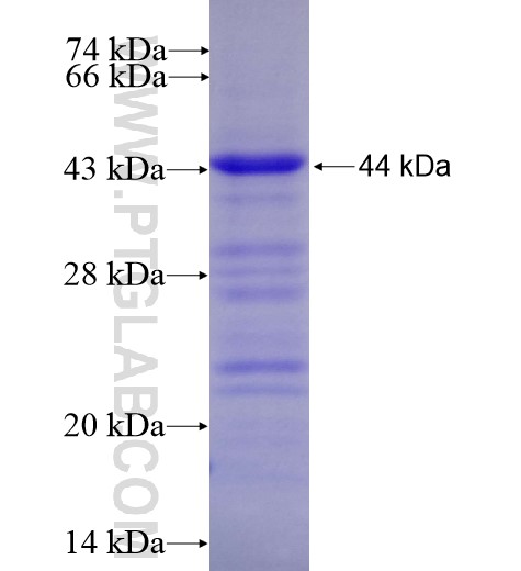PRKAA2 fusion protein Ag12789 SDS-PAGE PRKAA2 fusion protein Ag12789 SDS-PAGE